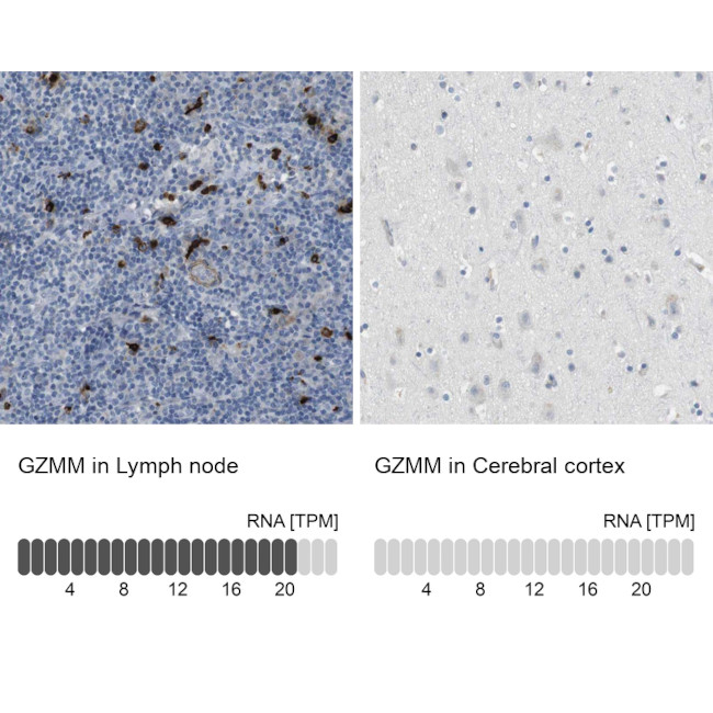 Granzyme M Antibody in Immunohistochemistry (IHC)