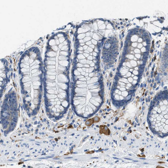 MAPRE2 Antibody in Immunohistochemistry (IHC)