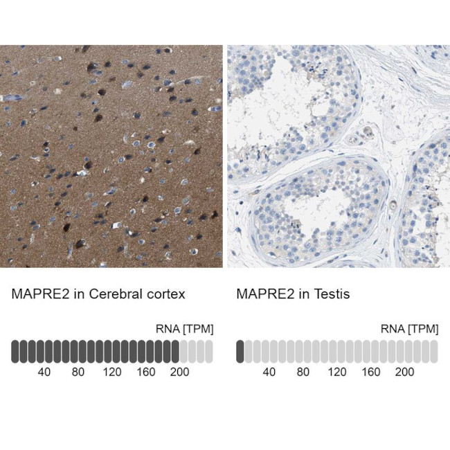 MAPRE2 Antibody