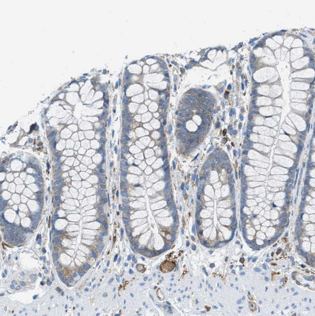 MAPRE2 Antibody in Immunohistochemistry (IHC)