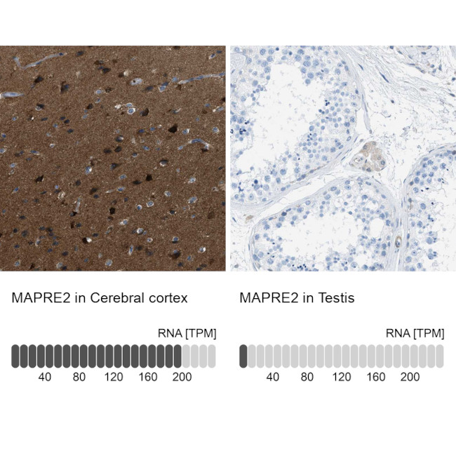 MAPRE2 Antibody