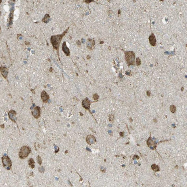 USP30 Antibody in Immunohistochemistry (IHC)