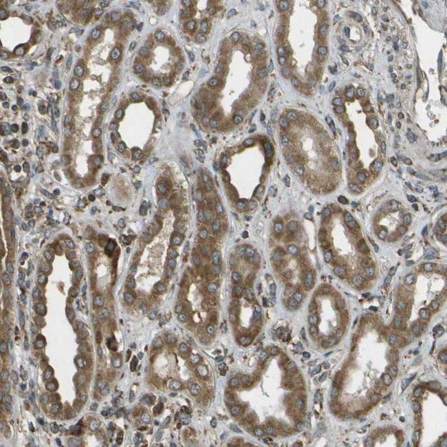 USP30 Antibody in Immunohistochemistry (IHC)