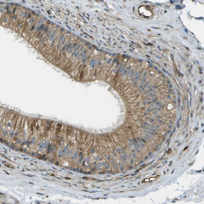 LRP12 Antibody in Immunohistochemistry (Paraffin) (IHC (P))