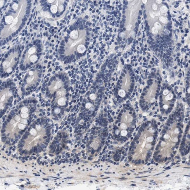 GPRASP2 Antibody in Immunohistochemistry (IHC)