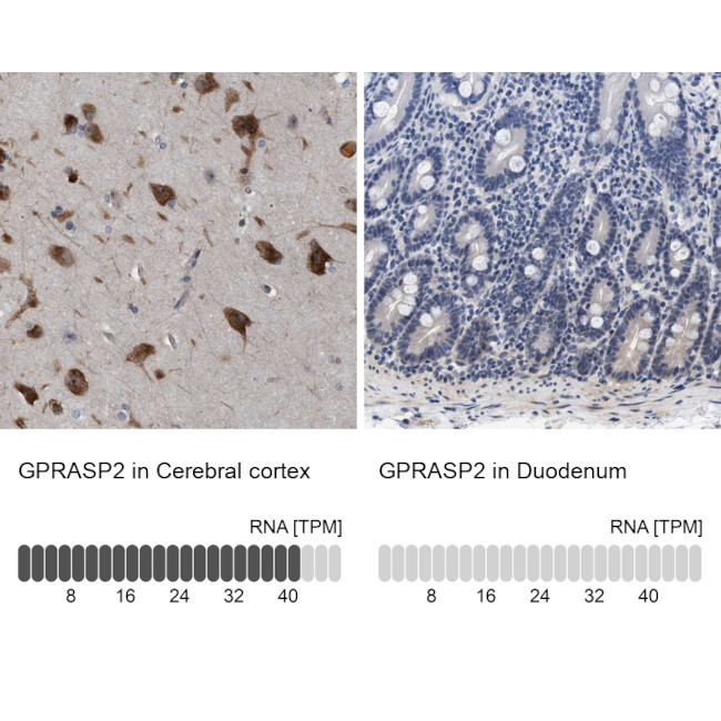 GPRASP2 Antibody