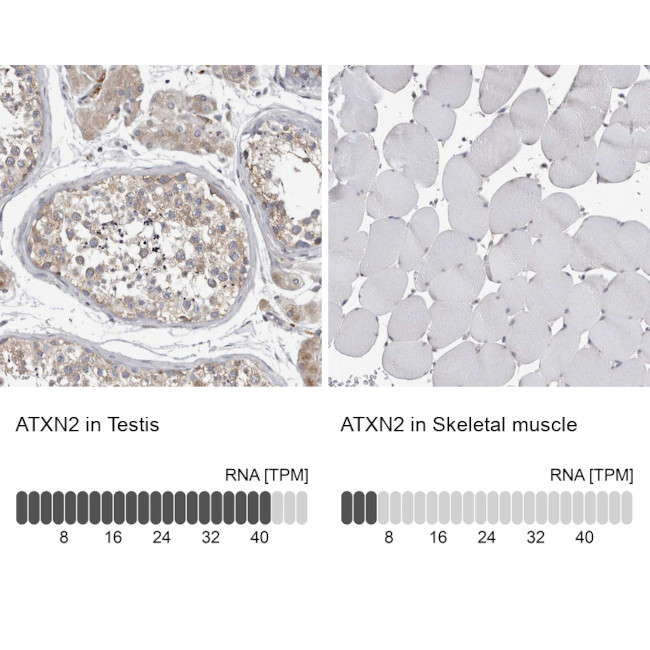 Ataxin 2 Antibody in Immunohistochemistry (IHC)