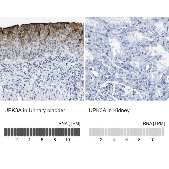 UPK3A Antibody in Immunohistochemistry (IHC)