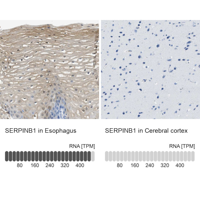 SERPINB1 Antibody in Immunohistochemistry (IHC)