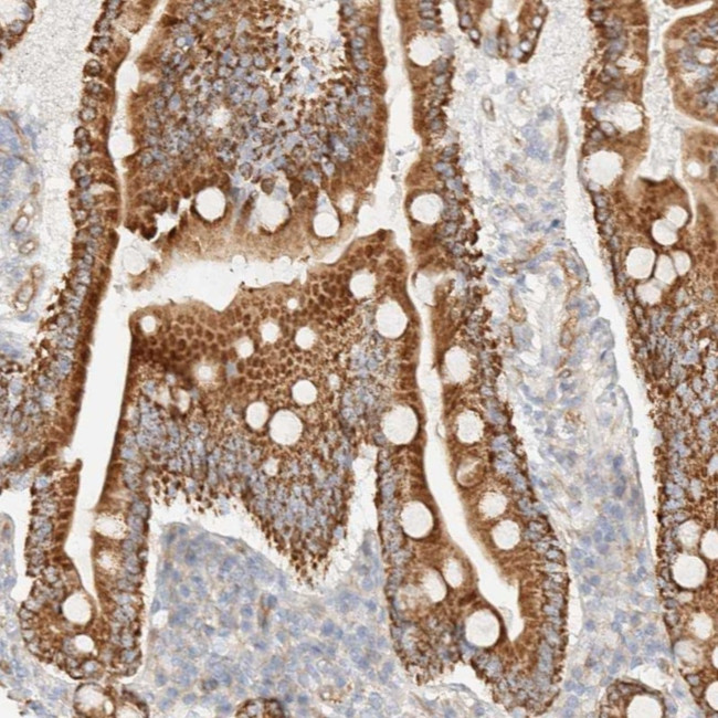 CYB5R4 Antibody in Immunohistochemistry (Paraffin) (IHC (P))