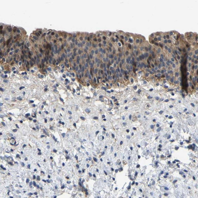 LIAS Antibody in Immunohistochemistry (Paraffin) (IHC (P))