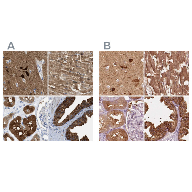 CRYM Antibody in Immunohistochemistry (IHC)