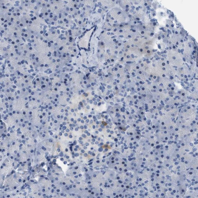 CRYM Antibody in Immunohistochemistry (IHC)