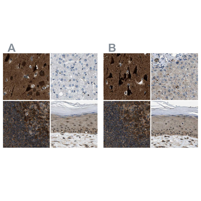 NUDCD3 Antibody in Immunohistochemistry (IHC)