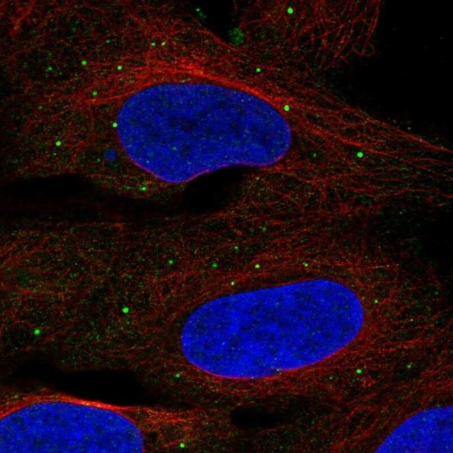 TMEM68 Antibody in Immunocytochemistry (ICC/IF)