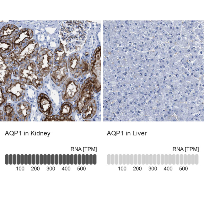 Aquaporin 1 Antibody in Immunohistochemistry (IHC)