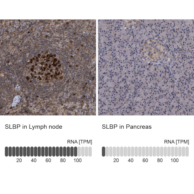 SLBP Antibody in Immunohistochemistry (IHC)