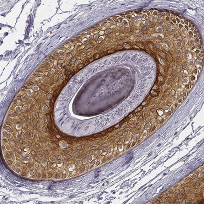 KRT75 Antibody in Immunohistochemistry (IHC)