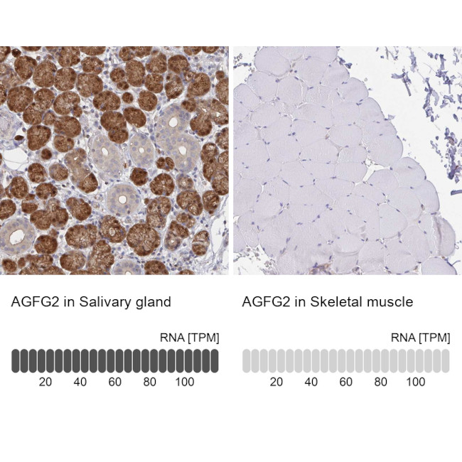 AGFG2 Antibody in Immunohistochemistry (IHC)