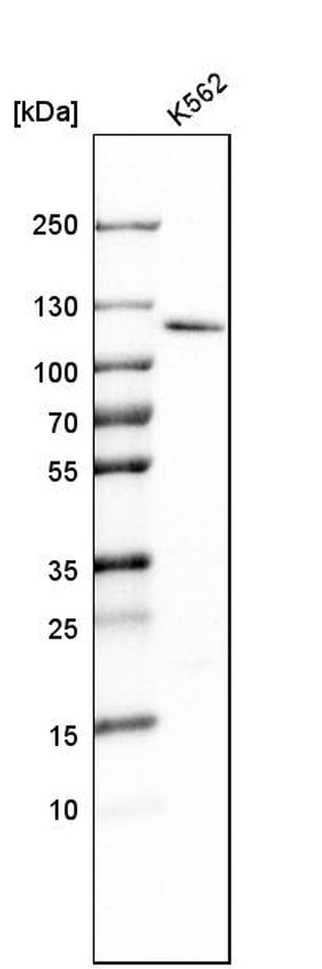 RBM15 Antibody in Western Blot (WB)