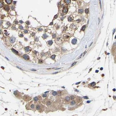 CCDC155 Antibody in Immunohistochemistry (IHC)