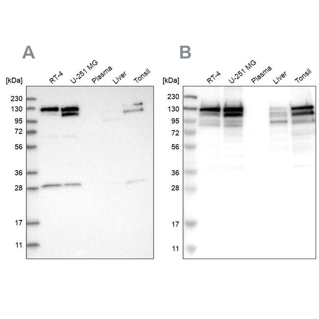 DBC1 Antibody in Western Blot (WB)