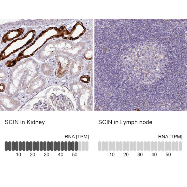 SCIN Antibody in Immunohistochemistry (IHC)