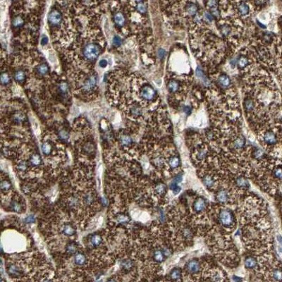 SHMT2 Antibody in Immunohistochemistry (IHC)