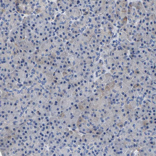 SQLE Antibody in Immunohistochemistry (IHC)