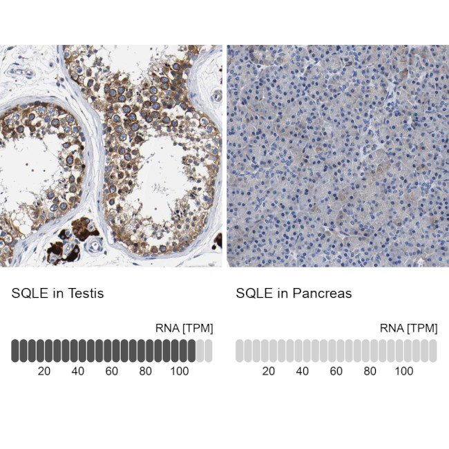 SQLE Antibody