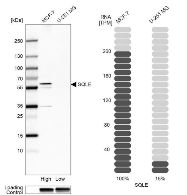 SQLE Antibody