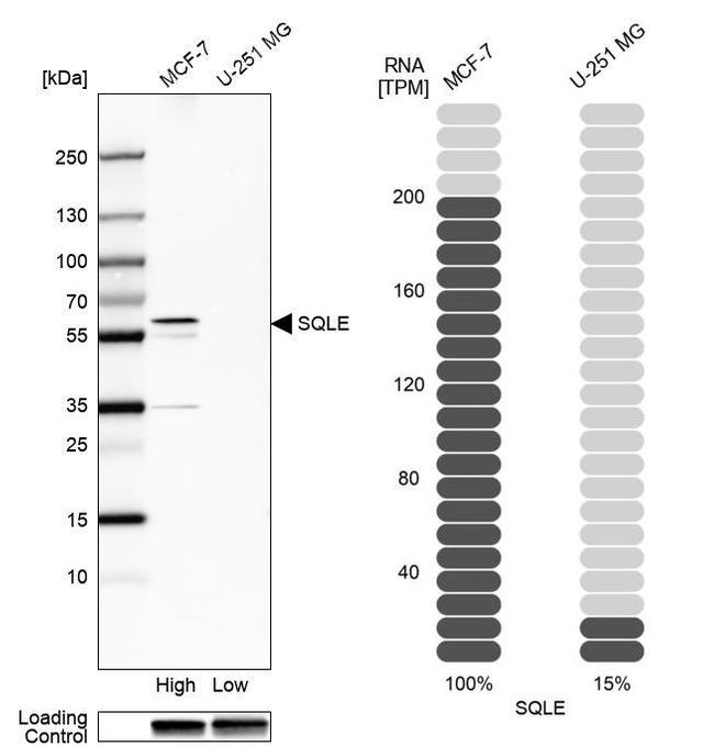 SQLE Antibody in Western Blot (WB)