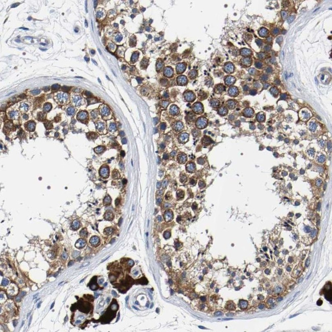 SQLE Antibody in Immunohistochemistry (IHC)