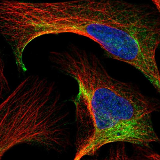 TCP-1 theta Antibody in Immunocytochemistry (ICC/IF)