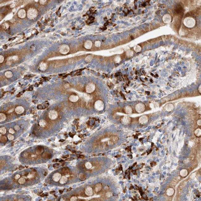 ENASE Antibody in Immunohistochemistry (Paraffin) (IHC (P))