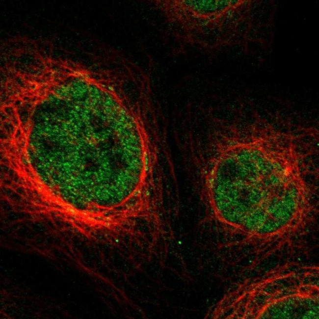 NPLOC4 Antibody in Immunocytochemistry (ICC/IF)