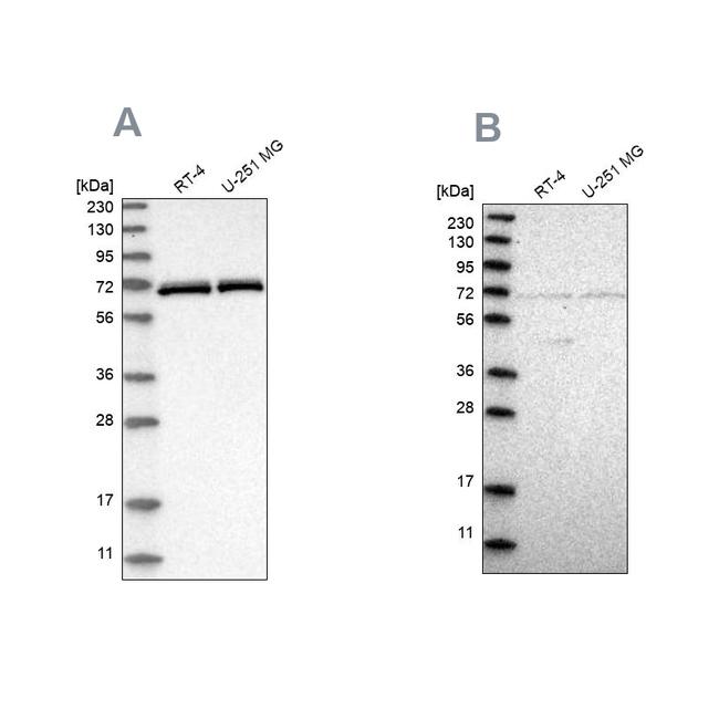 NPLOC4 Antibody in Western Blot (WB)