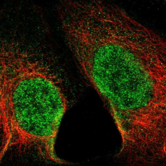 SETD1B Antibody in Immunocytochemistry (ICC/IF)