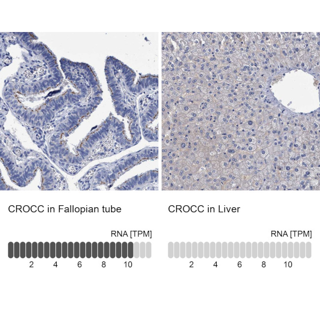 CROCC Antibody in Immunohistochemistry (IHC)