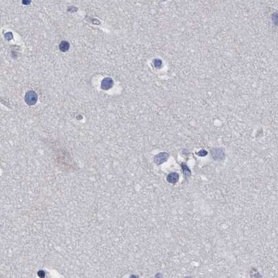 CROCC Antibody in Immunohistochemistry (IHC)