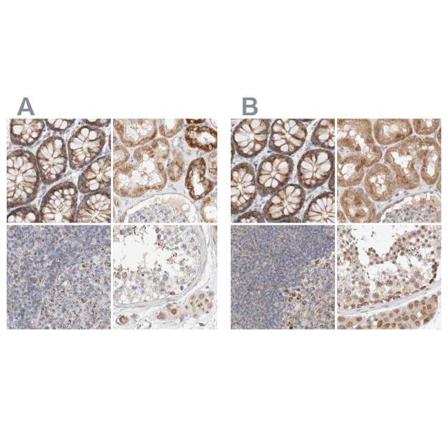 RNMTL1 Antibody in Immunohistochemistry (IHC)