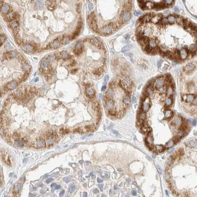 RNMTL1 Antibody in Immunohistochemistry (IHC)