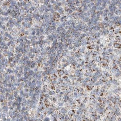 RNMTL1 Antibody in Immunohistochemistry (IHC)