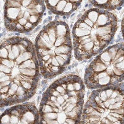 RNMTL1 Antibody in Immunohistochemistry (IHC)