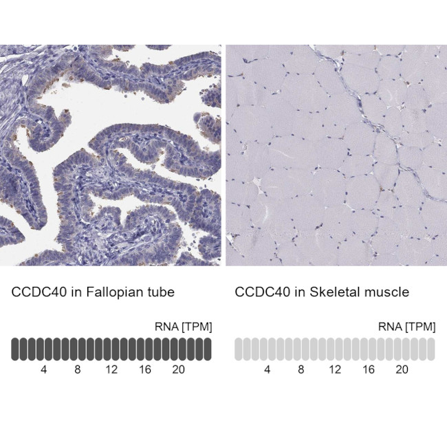 CCDC40 Antibody in Immunohistochemistry (IHC)