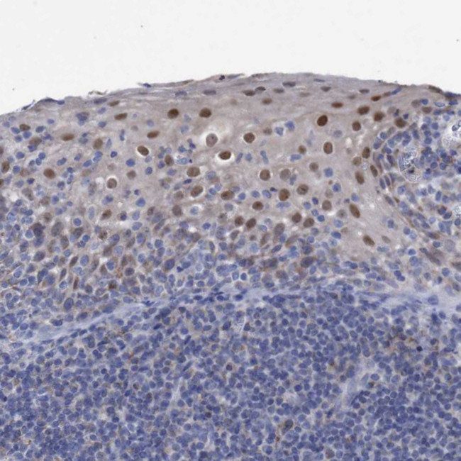 ZNF750 Antibody in Immunohistochemistry (IHC)