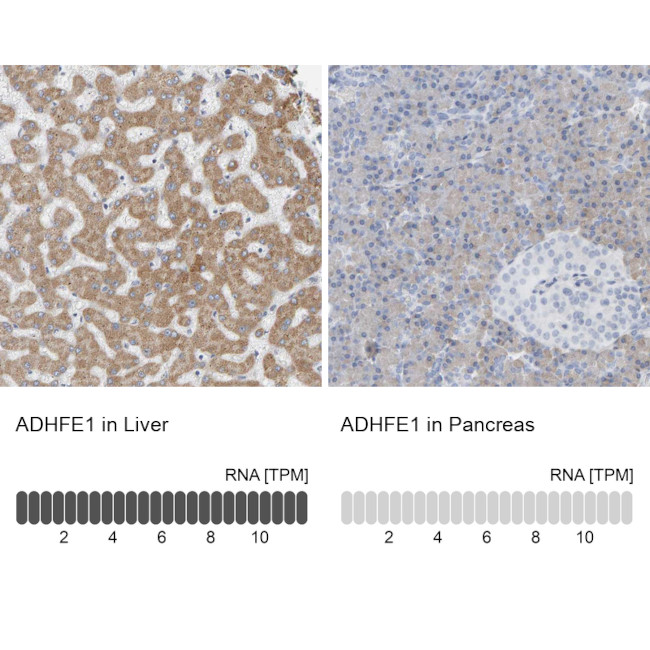 ADHFE1 Antibody in Immunohistochemistry (IHC)