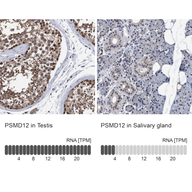 PSMD12 Antibody in Immunohistochemistry (IHC)