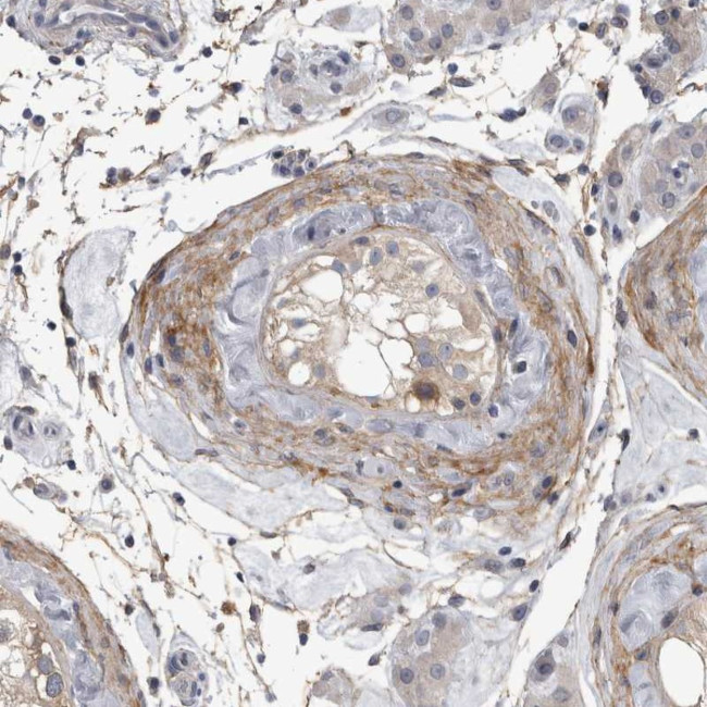 EFEMP2 Antibody in Immunohistochemistry (Paraffin) (IHC (P))