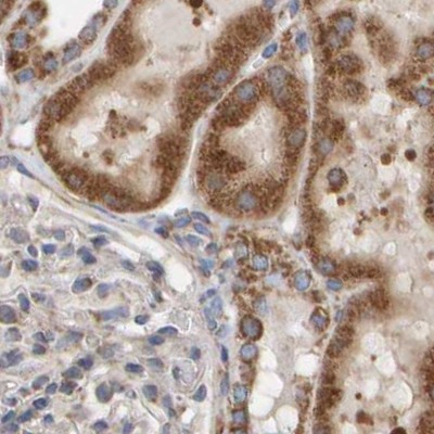 MRPL45 Antibody in Immunohistochemistry (IHC)
